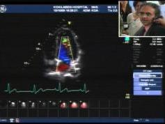 Insat 3A at 93.5 e _ feeds 4 053 V feeds from Kokilaben Hospital India  04